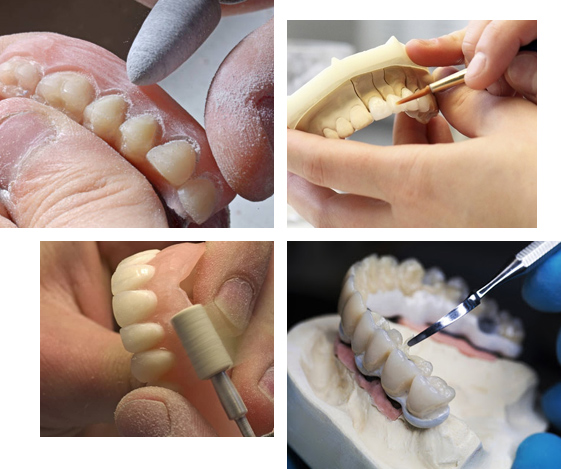 Dentures Suppliers